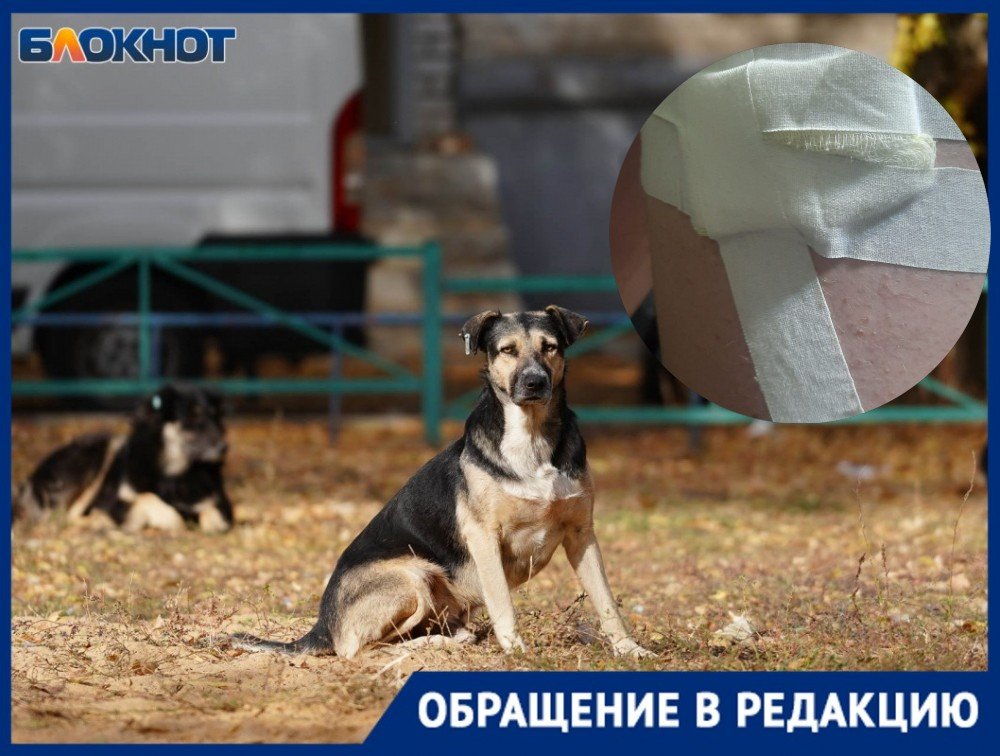Бродячая собака прокусила школьнику бедро под Волгоградом