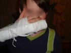 На севере Волгограда 11-летний мальчик сломал руку гимназисту во время игры