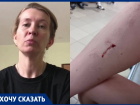 Мамы просят усмирить злобную овчарку, напавшую на двоих детей в Волгограде