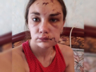 Прохор Шаляпин поддержал жительницу Урюпинска, которой экс-супруг порезал лицо
