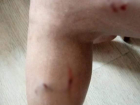 Бродячие собаки искусали волгоградку на остановке