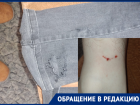 Десятилетнюю девочку отбили из пасти собаки в Волгограде
