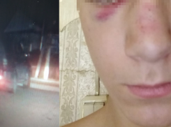 «Дал салфетку и 1000 рублей»: под Волгоградом спешащий на службу водитель сбил подростка и скрылся