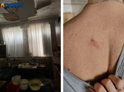 «Инвалид уже сварился»: потолок обрушился в общежитии в Волгограде