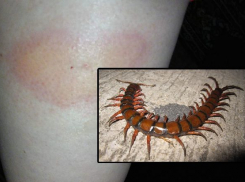 20-сантиметровая сколопендра отправила женщину на больничную койку под Волгоградом