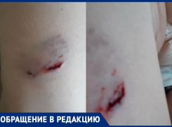 На жительницу Городище у здания прокуратуры набросилась стая бродячих собак: пес разорвал женщине ногу