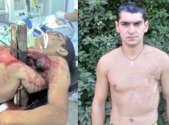 Под Волгоградом из груди  24-летнего парня хирурги вытащили 4 метровый брус