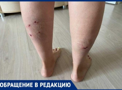 Свора собак искусала волгоградку: девушка закрыла собой коляску с 10-месячной дочкой