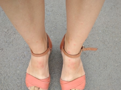 Стая  блох атаковала жильцов многоквартирного дома на севере Волгограда