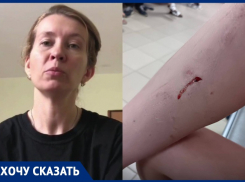 Мамы просят усмирить злобную овчарку, напавшую на двоих детей в Волгограде