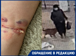 Зверское нападение голодной собаки-рецидивистки на волгоградку попало на видео