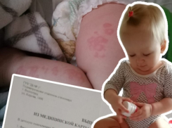 Нервный тик и жуткую аллергию получила годовалая девочка после лечения в больнице Волгограда