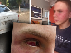 Избитого волгоградскими полицейскими школьника выписали из больницы: впереди долгое лечение