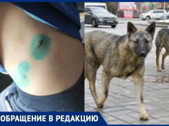 Собака покусала 4-летнего мальчика на детской площадке в Волгограде