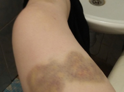 Волгоградка опубликовала фото жутких побоев мужа