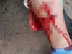 Собака в кровь искусала женщину в Волгограде