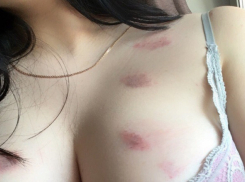 Бурная личная жизнь оставила многочисленные следы на груди волгоградки