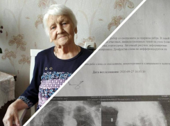 «Состояние улучшилось»: 82-летнюю пенсионерку с 5 сломанными ребрами госпитализировали после публикации «Блокнот Волгоград»