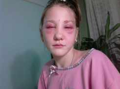 Волгоградскую парикмахерскую оштрафовали на 30 тысяч за сожженные глаза 13-летней девочки