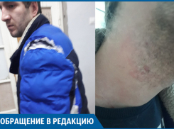 Травматолог избивал и душил моего брата в поликлинике №1, - волгоградец