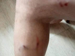 Бродячие собаки искусали волгоградку на остановке