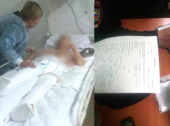 В преддверии 2 февраля в волгоградской реанимации «Дитя Сталинграда» сломали обе ноги