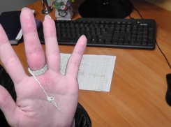 В Волгограде спасатели сняли тесное кольцо с пальца 12-летней девочки