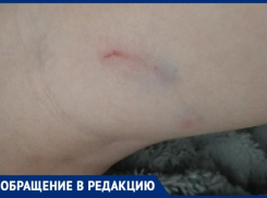 Стая бродячих собак покусала второклассника в «Родниковой Долине» в Волгограде