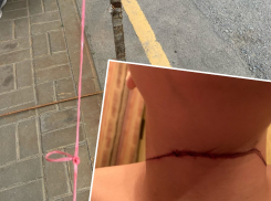 12-летний мальчик получил жуткие травмы на шее из-за натянутой веревки во дворе дома в Волгограде