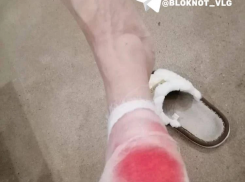 Агрессивная дворняга нашла жертву у волгоградской школы