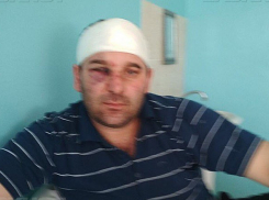 У главы села Дубовского района забрали ружье после жестокого избиения мужчины