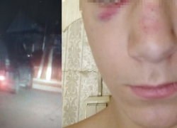 «Дал салфетку и 1000 рублей»: под Волгоградом спешащий на службу водитель сбил подростка и скрылся