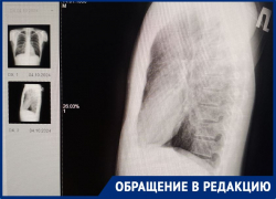 «Ждали 5,5 часов»: волгоградка пожаловалась на отказ врачей принимать ее мужа с куском лома в груди 