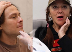 Бабули упадут: омоложение лица ботоксом сделал Прохор Шаляпин 