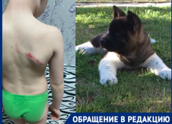 Семилетний волгоградец получил 6 уколов от бешенства после нападения американской акиты