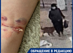 Зверское нападение голодной собаки-рецидивистки на волгоградку попало на видео