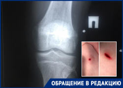 Детей обстреляли в Волгограде, двое госпитализированы