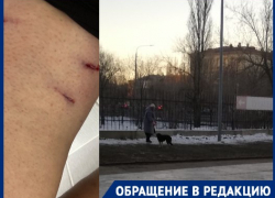 Бездомная собака прогрызла ногу волгоградке у входа в ТЦ: видео