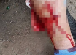 Собака в кровь искусала женщину в Волгограде