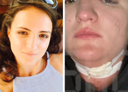 Распоротым горлом сотрудницы МЧС в Волгограде занялся Александр Бастрыкин