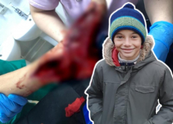 Мотороллер разрубил 12-летнему ребенку ногу в Волгоградской области:  родители требуют наказания для виновных