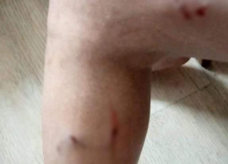 Бродячие собаки искусали волгоградку на остановке