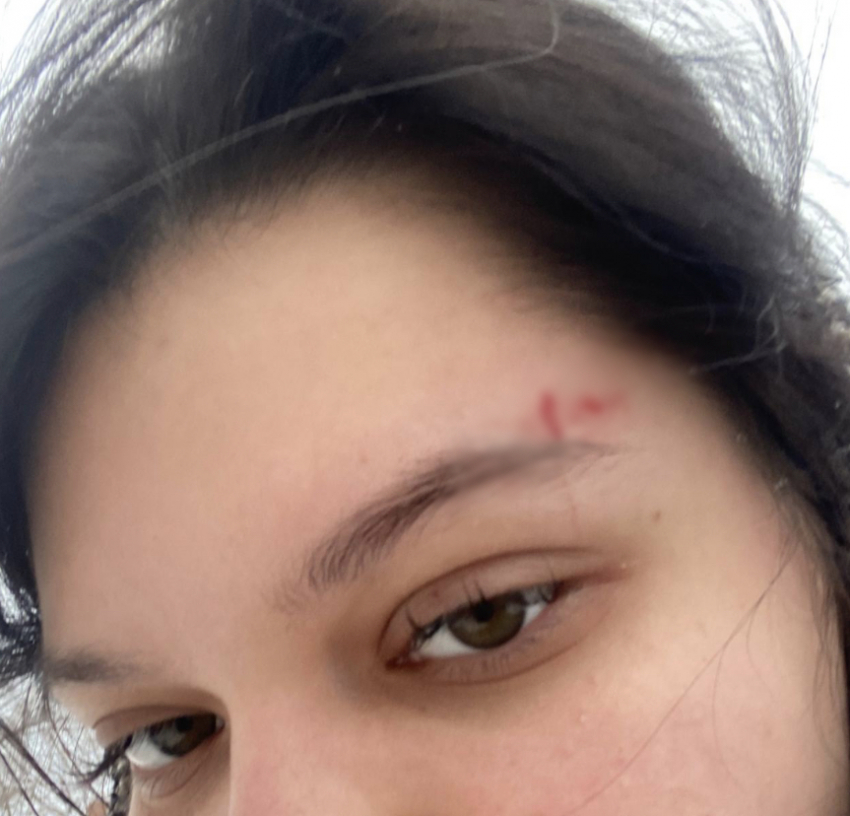Девушка разбила лицо об лед на скользких дорогах Волгограда