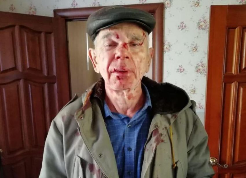 74-летнего собачника избил незнакомец рядом с техникумом в Волгограде