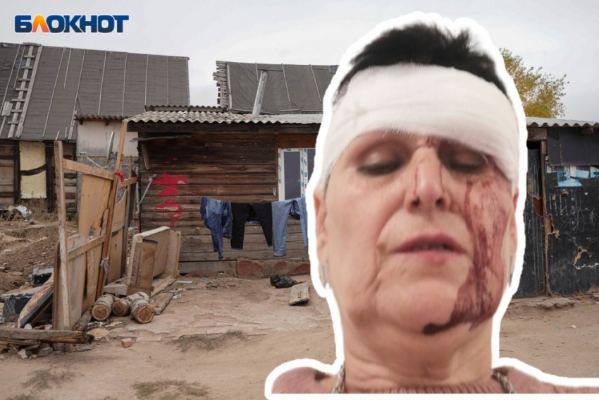 В Волгограде разбитую голову русской женщины в цыганском посёлке списали на случайность