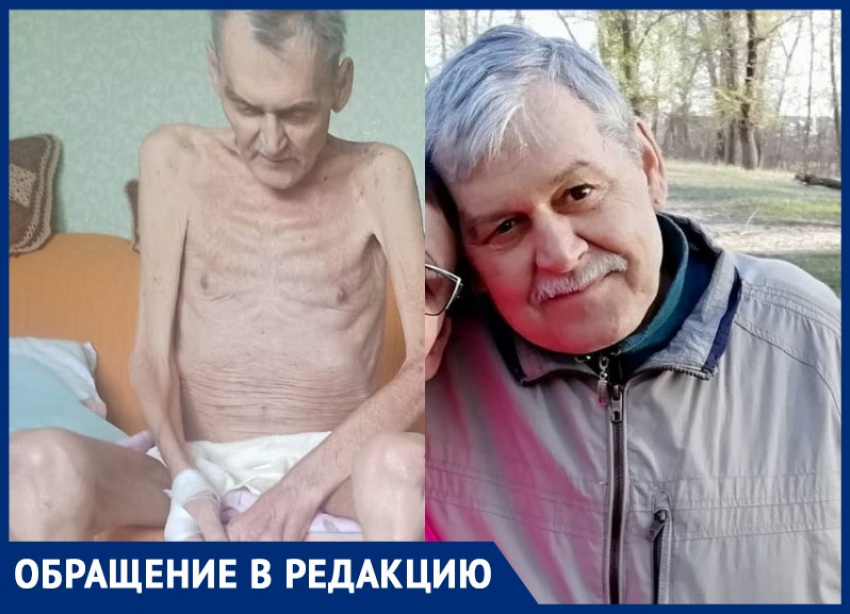 64-летний мужчина сбросил 35 кг за 4 месяца: врачи разводят руками и отправляют в хоспис в Волгоградской области