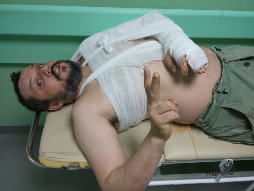 Из-за вооруженного нападения волгоградский художник Митя Зимин лишился возможности работать