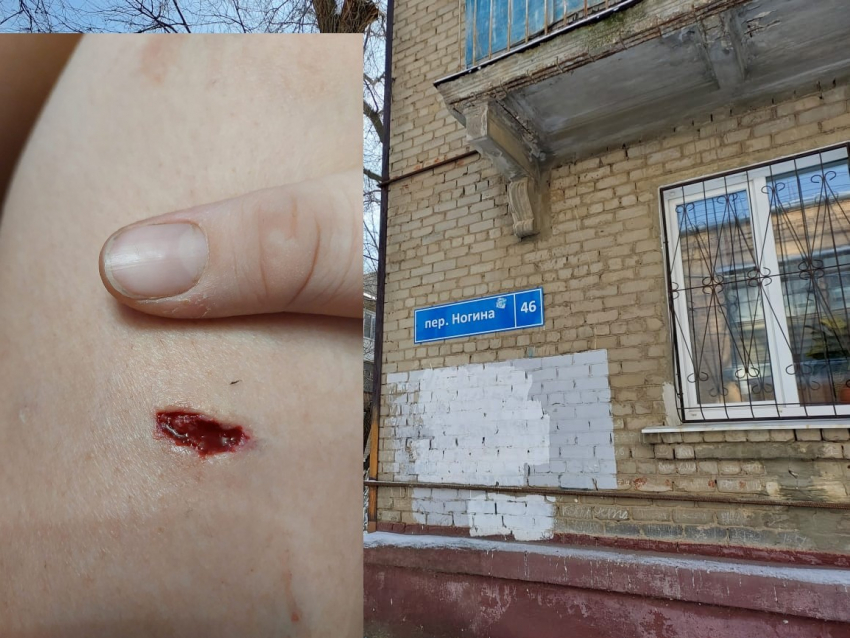 Стая из 8 собак напала на 12-летнего школьника в Волгограде