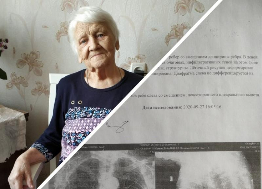 82-летнюю пенсионерку с 5 сломанными ребрами не стали лечить в больнице №25 Волгограда и отправили домой 