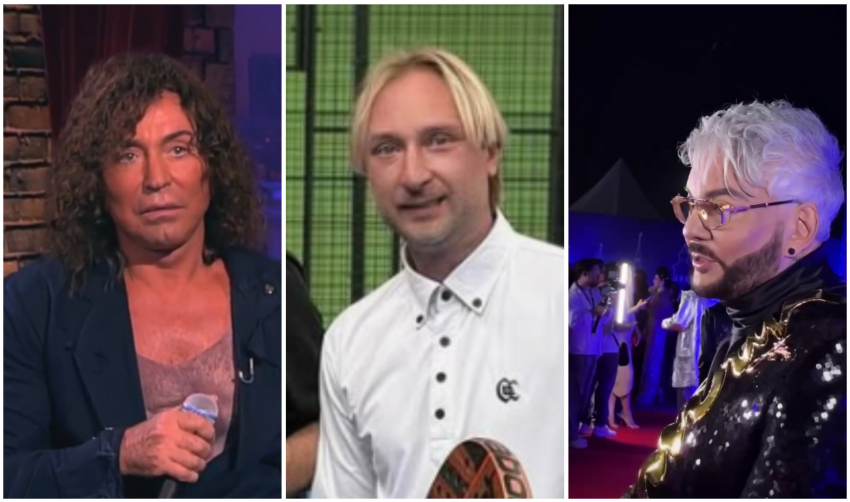 Что сотворили хирурги с Плющенко, Киркоровым и Леонтьевым и кто прячет под волосами карту шрамов